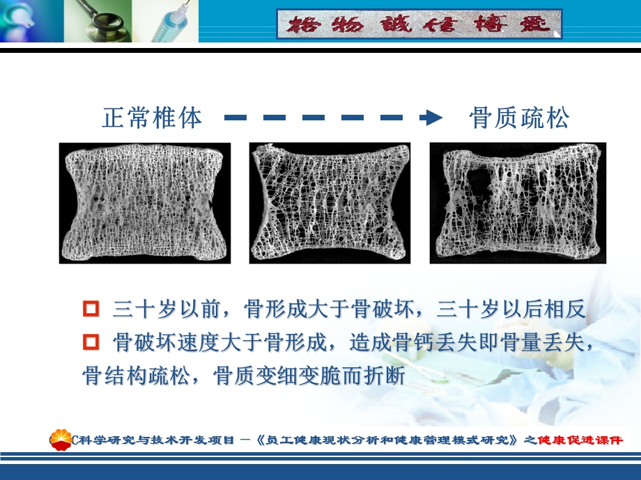 骨质疏松的健康管理.ppt.ppt_第2页