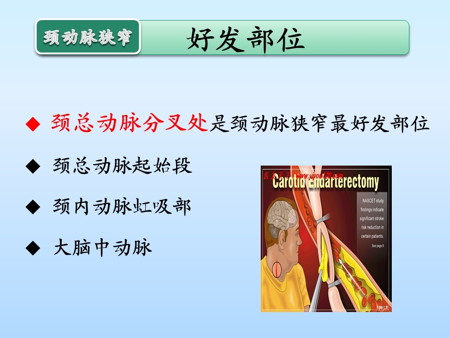 颈动脉狭窄的治疗与护理第四军医大学唐都医院神经外科王学廉.ppt_第3页