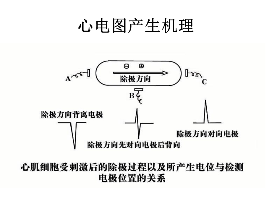 围术期常见的异常心电图分析.ppt_第2页