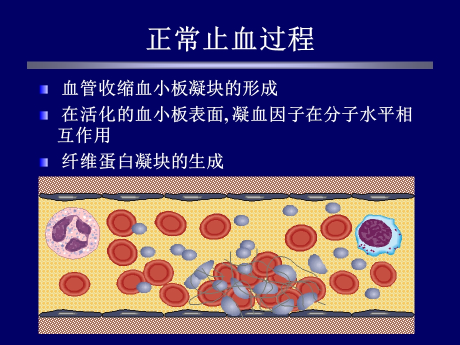 基因重组活化vii因子的临床应用.ppt_第2页