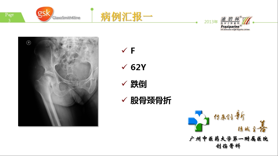 【血栓】医学知识精品PPT教程.ppt_第3页