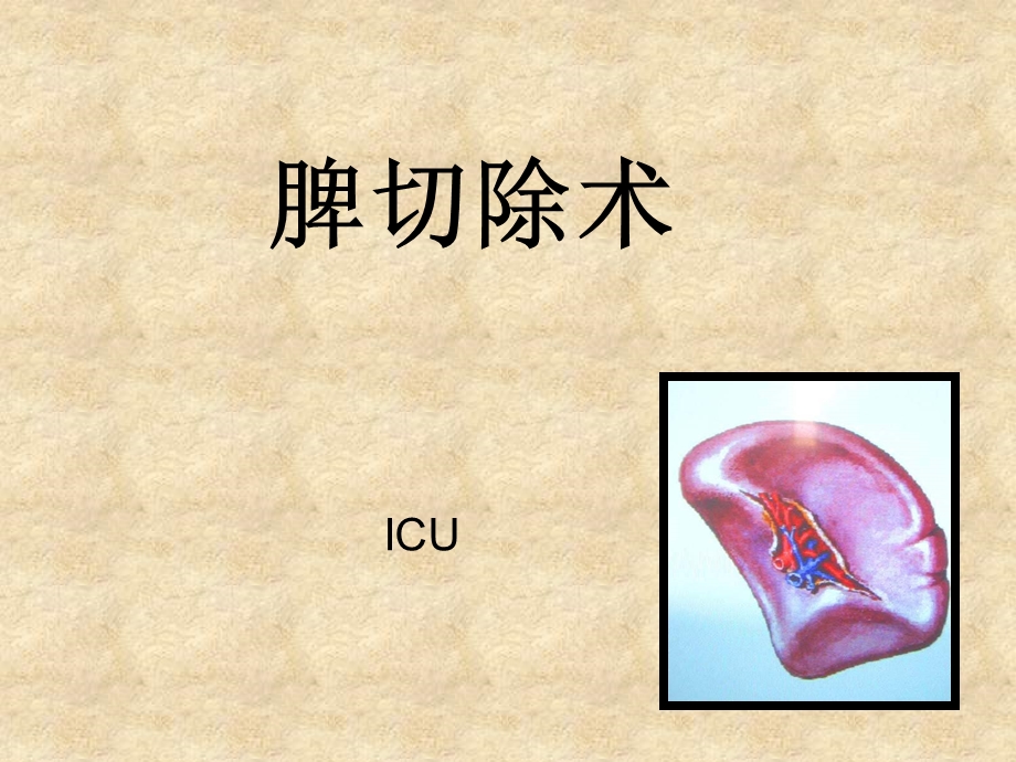 脾切除术的护理.ppt_第1页