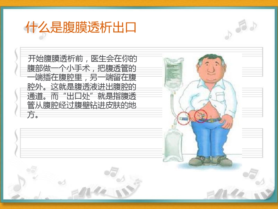 腹膜透析出口护理.ppt_第2页