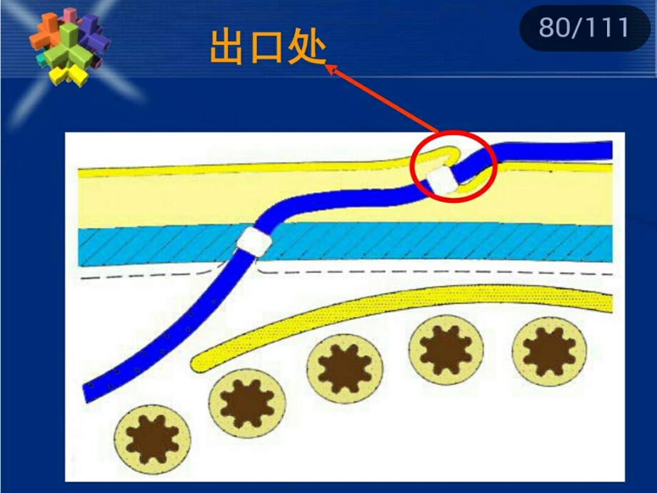 腹膜透析出口护理.ppt_第3页