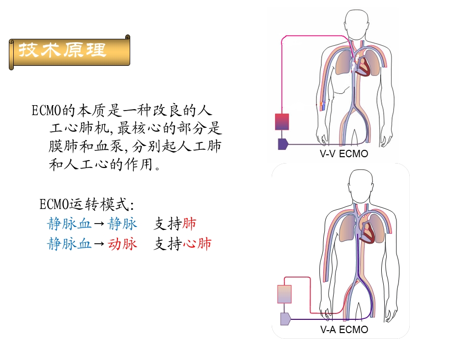 ECMO治疗危重患者进展.ppt_第3页