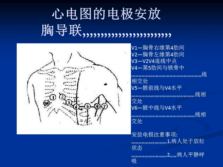 4274000366[整理版]心电图,三基培训.ppt_第2页