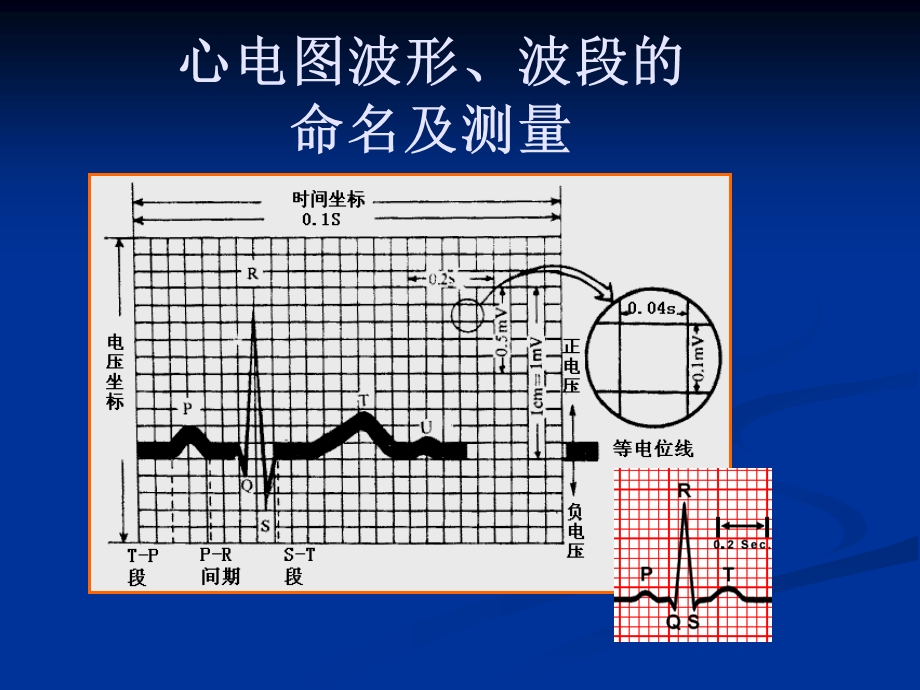 4274000366[整理版]心电图,三基培训.ppt_第3页