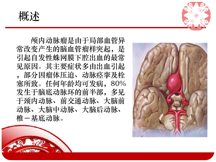 动脉瘤患者手术护理查房.ppt_第3页