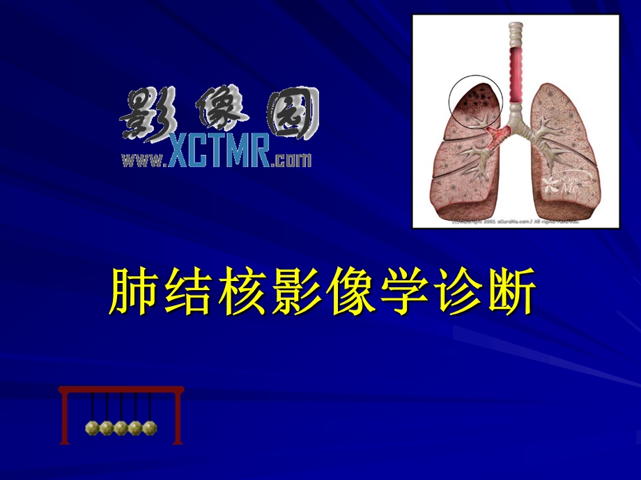 0249肺结核影像学诊断.ppt_第1页