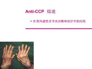 CCP抗环状胍氨酸肽抗体.ppt