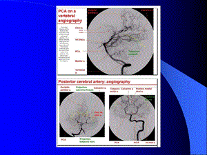 脑血管解剖与影像学2.ppt