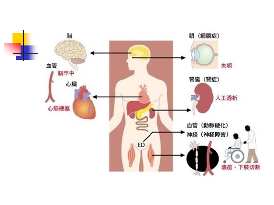 糖尿病肾病分期.ppt_第2页