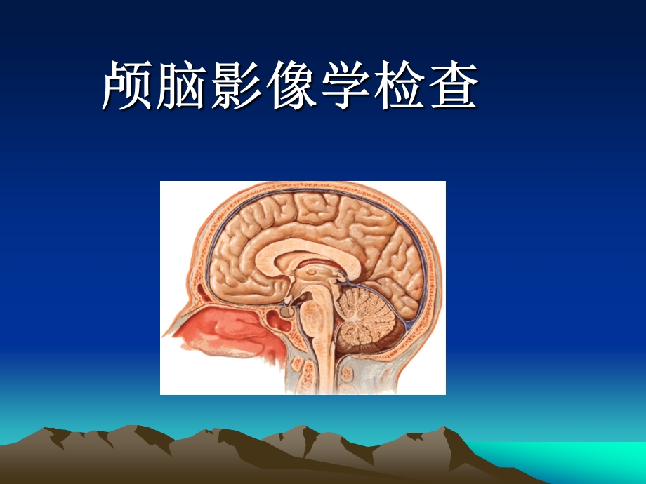 脑血管病的影像学检查.ppt_第1页