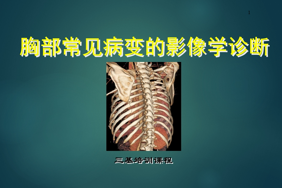 胸部常见病变的影像学诊断.ppt_第1页