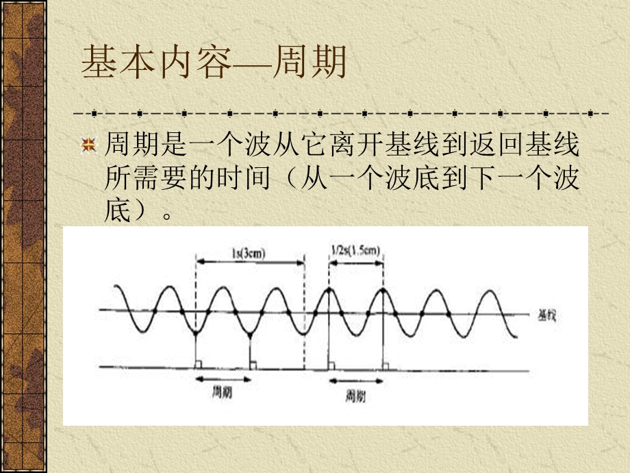 脑电图的临床应用.ppt_第3页