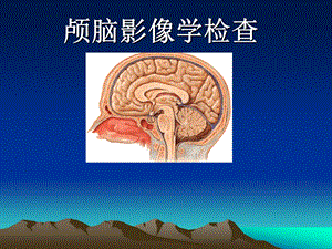 颅脑影像学检查.ppt