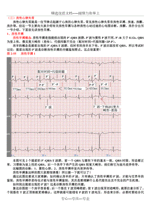 另类心电图讲义-3---房性心律失常.doc