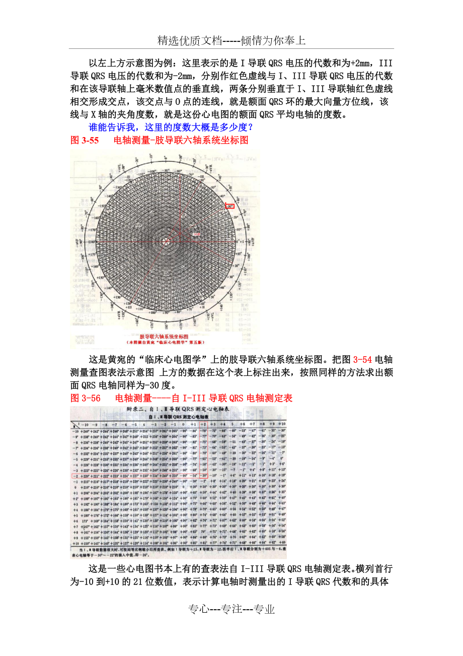 另类心电图学讲义6--QRS额面电轴.doc_第2页