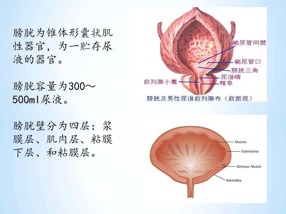 膀胱癌根治术患者护理查房课件.ppt_第3页