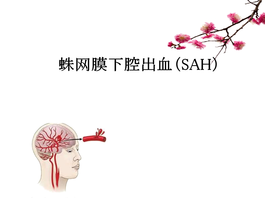 蛛网膜下腔出血的进展与护理课件.ppt_第1页