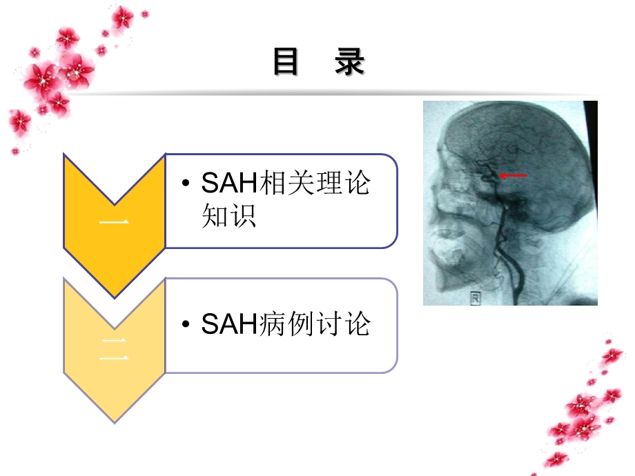 蛛网膜下腔出血的进展与护理课件.ppt_第2页