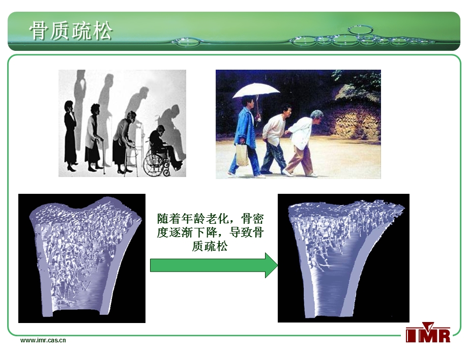 补钙的同时请补镁课件.ppt_第2页