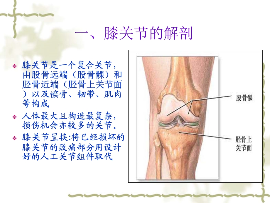 膝关节护理查房课件.ppt_第3页