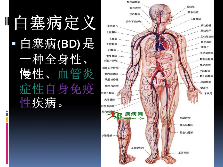 白塞病病例讨论ppt课件.ppt_第3页