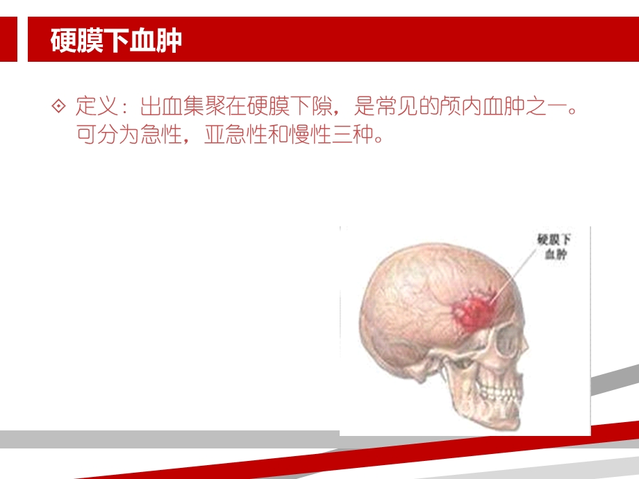 硬膜下血肿的护理查房课件.ppt_第3页