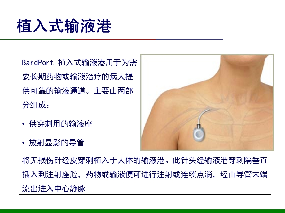 输液港护理查房优质ppt课件.ppt_第2页