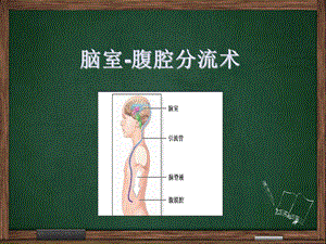 脑室腹腔分流术课件.ppt