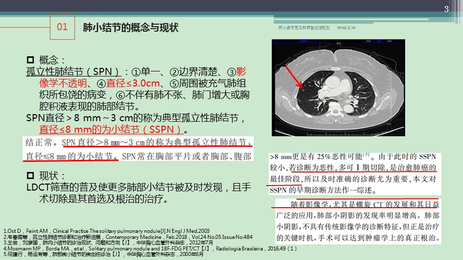 肺小结节定位和肺段切除规划课件.ppt_第3页