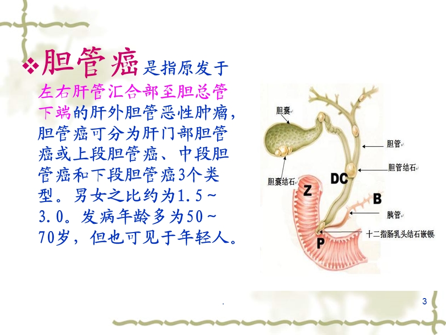 胆管癌的治疗及护理医学ppt课件.ppt_第3页