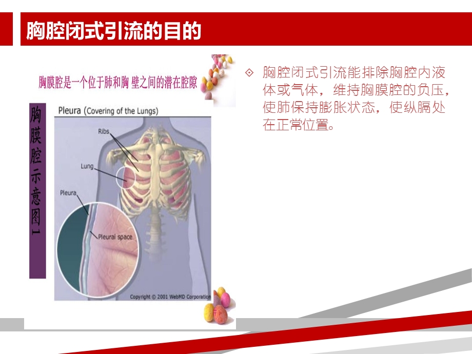 胸腔闭式引流的护理及注意事项课件.ppt_第3页