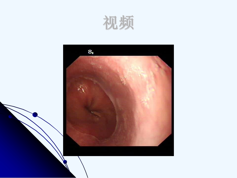 胃十二指肠疾病的内窥镜诊断课件.ppt_第2页