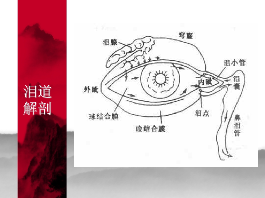 泪道冲洗医学课件.ppt_第3页