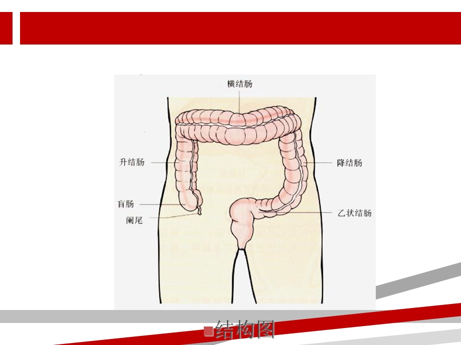 结直肠癌护理课件.ppt_第3页