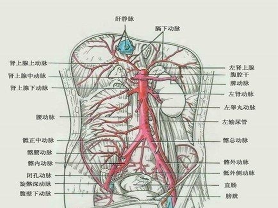 腹主动脉瘤的护理(讲课)课件.ppt_第3页