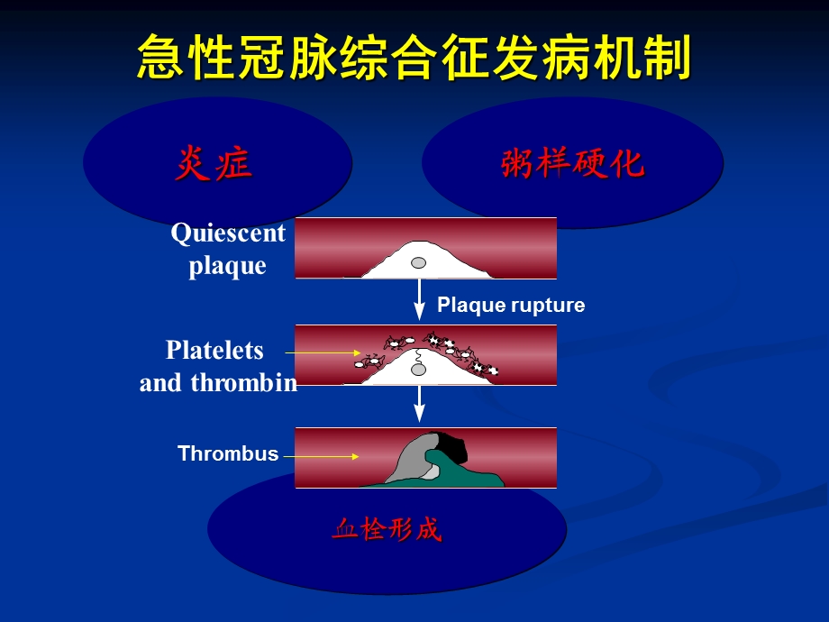 替罗非班专家版课件.ppt_第3页