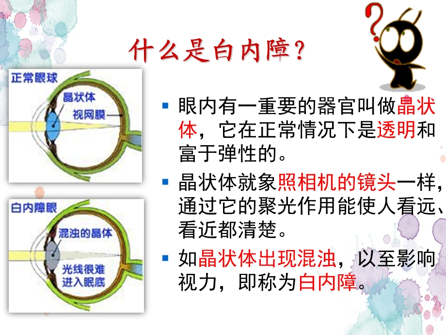 白内障科普讲座医学课件.ppt_第3页