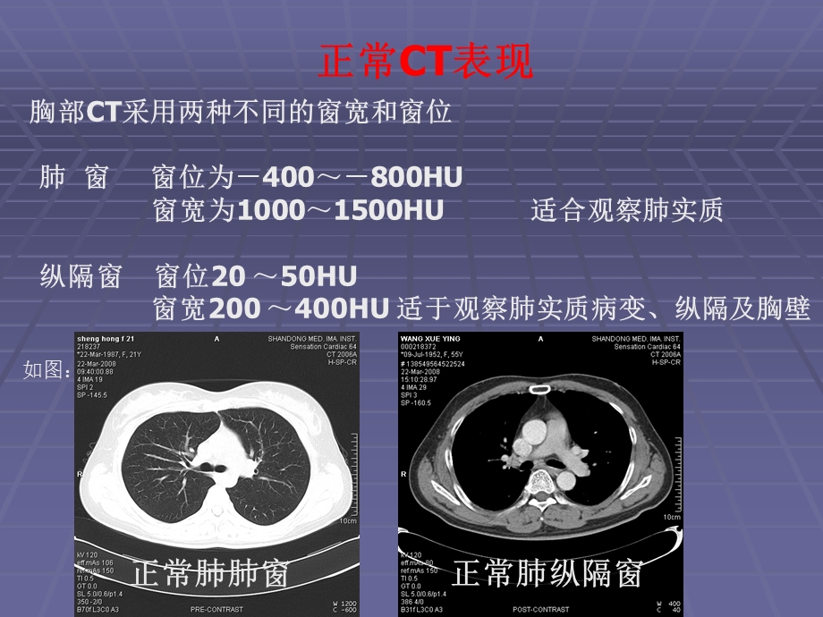 正常胸肺部CT影像学表现课件.ppt_第2页