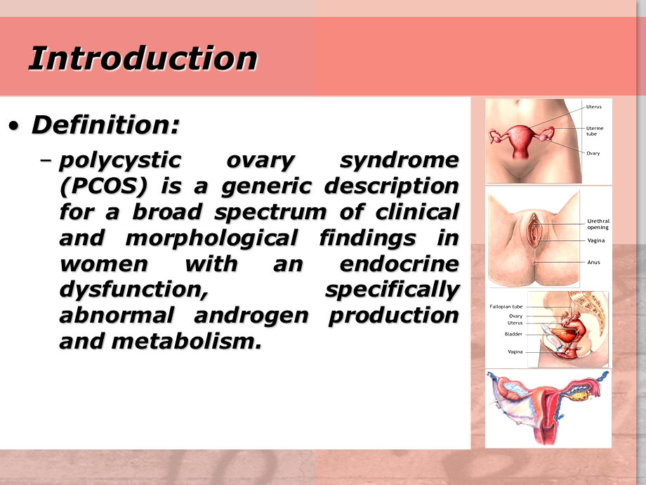 多囊性卵巢综合征(Polycystic-Ovary-Syndrome)课件.ppt_第2页