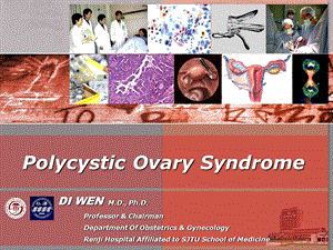 多囊性卵巢综合征(Polycystic-Ovary-Syndrome)课件.ppt