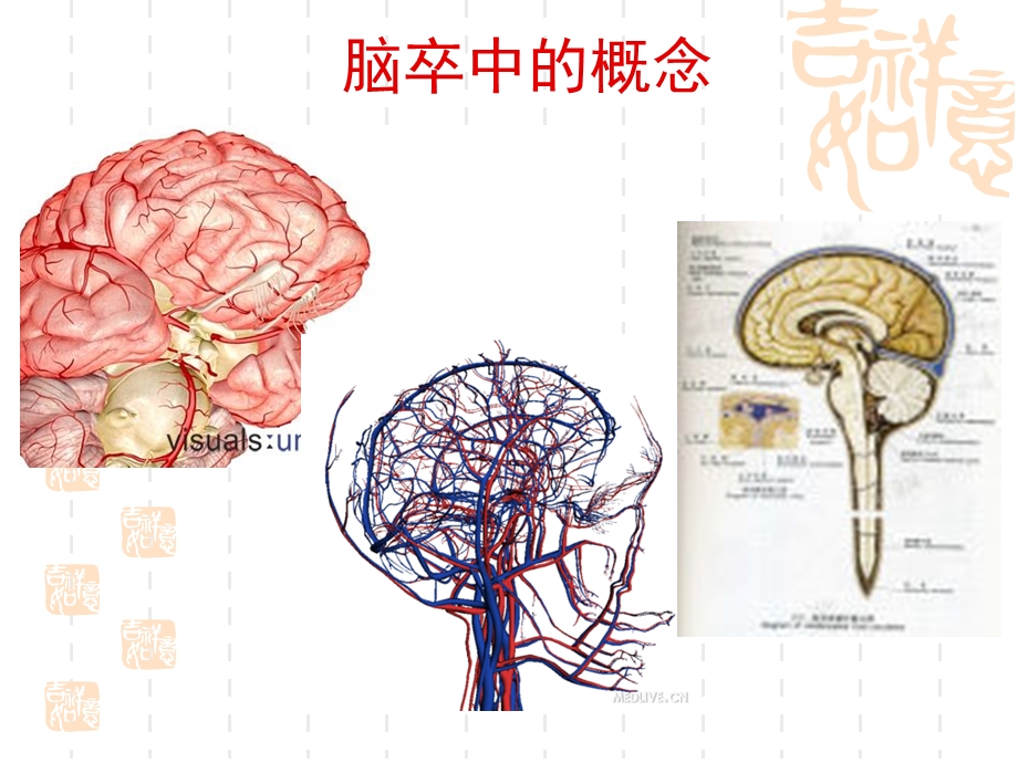 卒中护理课件.ppt_第3页