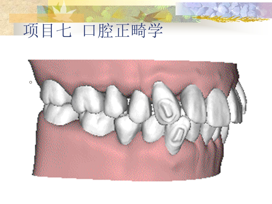 口腔正畸学概述汇总课件.ppt_第2页