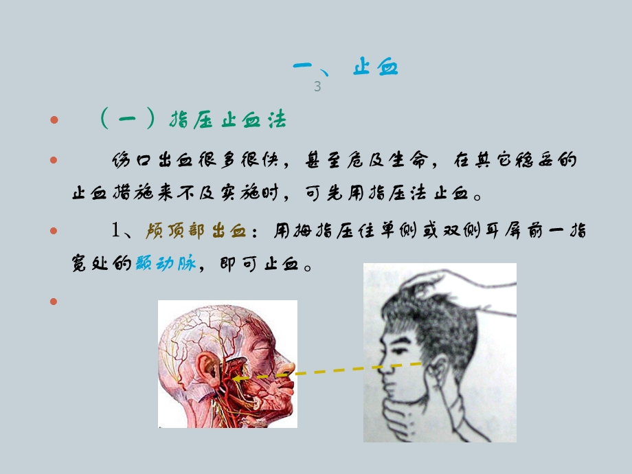 创伤现场急救的四项基本技术课件.ppt_第3页