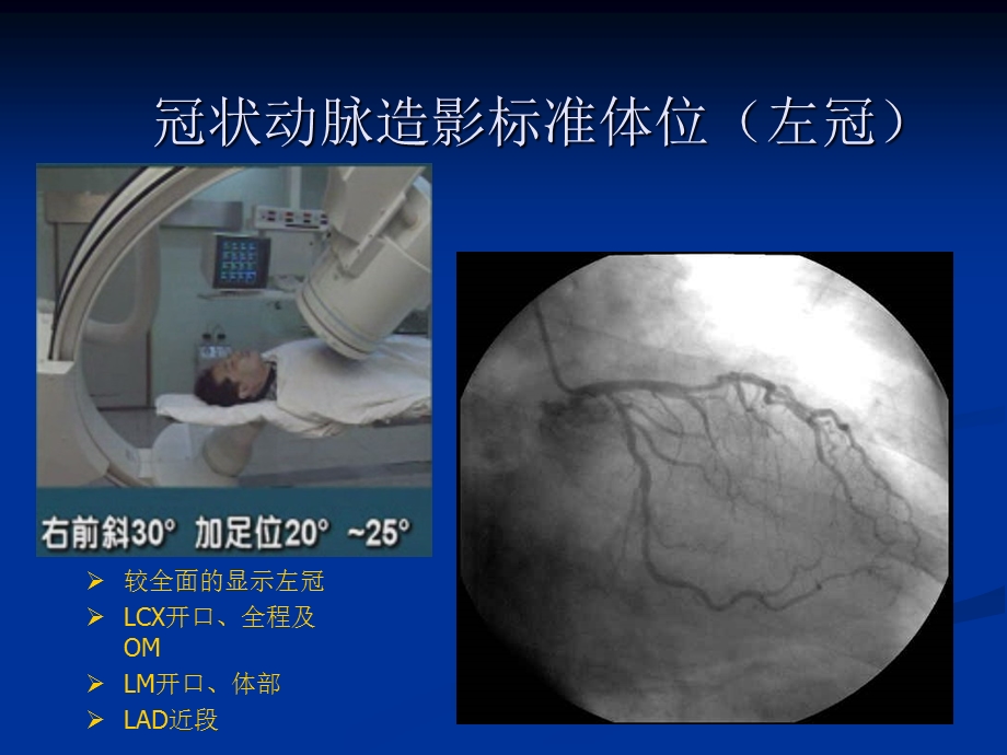 冠脉造影投照体位1汇总课件.ppt_第2页