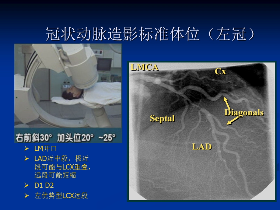 冠脉造影投照体位1汇总课件.ppt_第3页