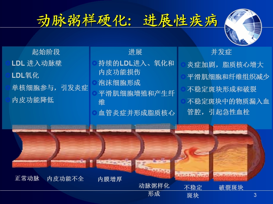 心肌梗死PPT幻灯片课件.ppt_第3页