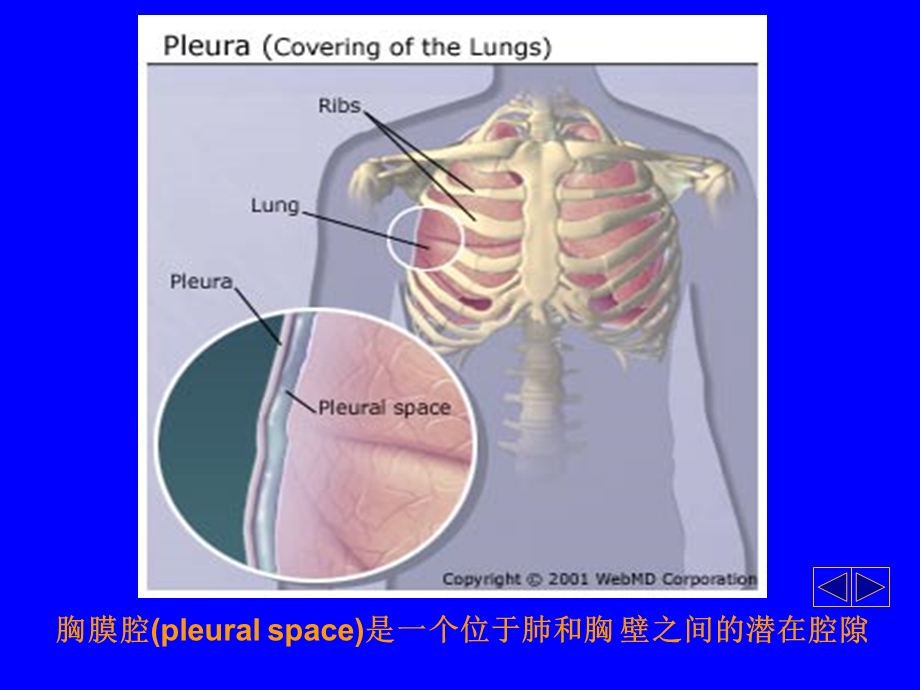胸腔积液解析课件.ppt_第2页